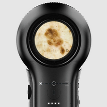 Lataa kuva Galleria-katseluun, Kopio: DermLite DL5 - dermatoskooppi